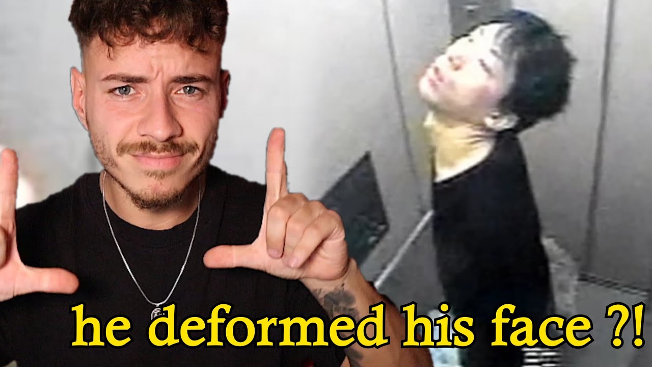 He deformed his face ?!