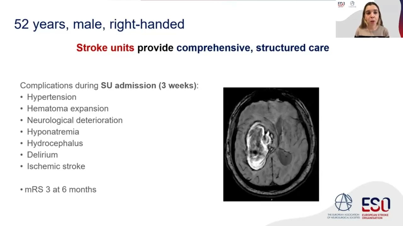 ESO-EANS Guideline on stroke due to spontaneous intracerebral haemorrhage