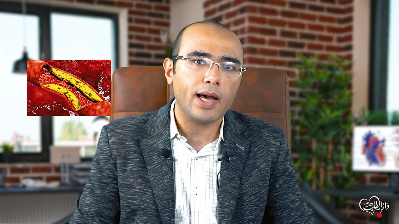 أنا ركبت دعامة في الشريان التاجي! أعمل ايه علشان أحافظ علي نفسي؟