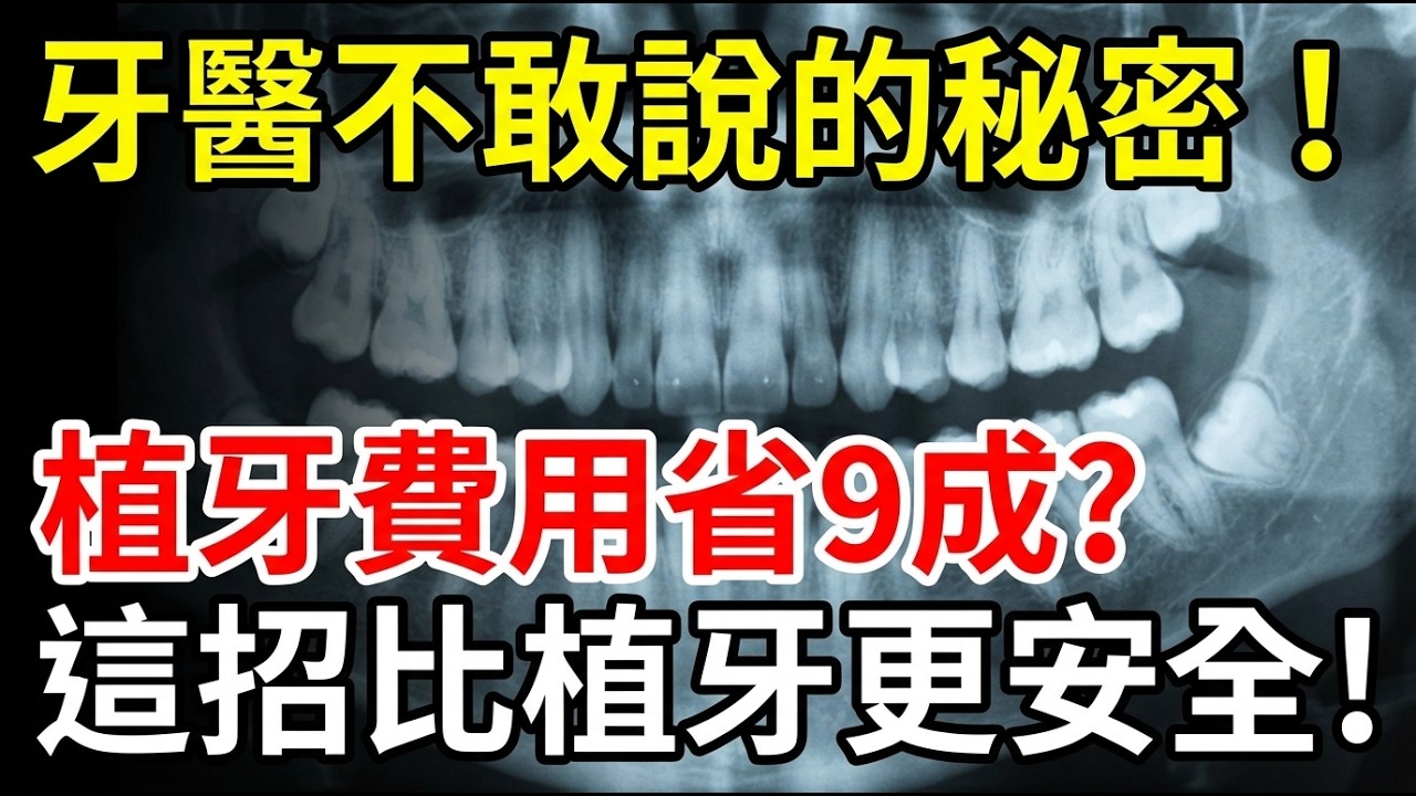 牙醫為什麼瘋狂推你植牙？資深牙醫坦白：還有一招省九成、效果更好！