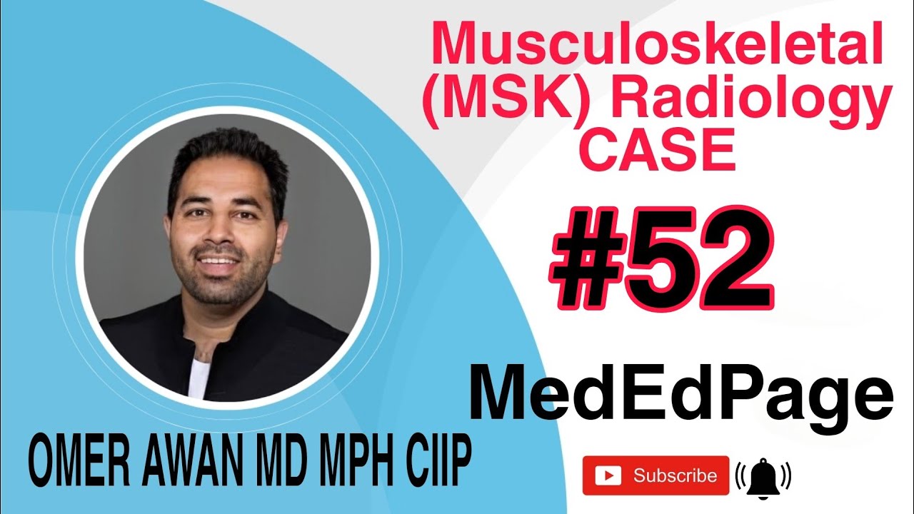 Musculoskeletal (MSK) Radiology CASE #52