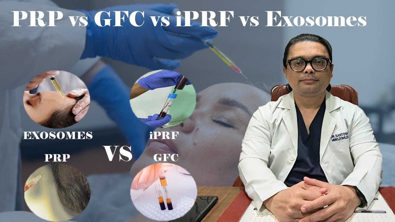 Hair Growth Treatment PRP vs GFC  vs iPRF vs Exosome for Hair Loss 