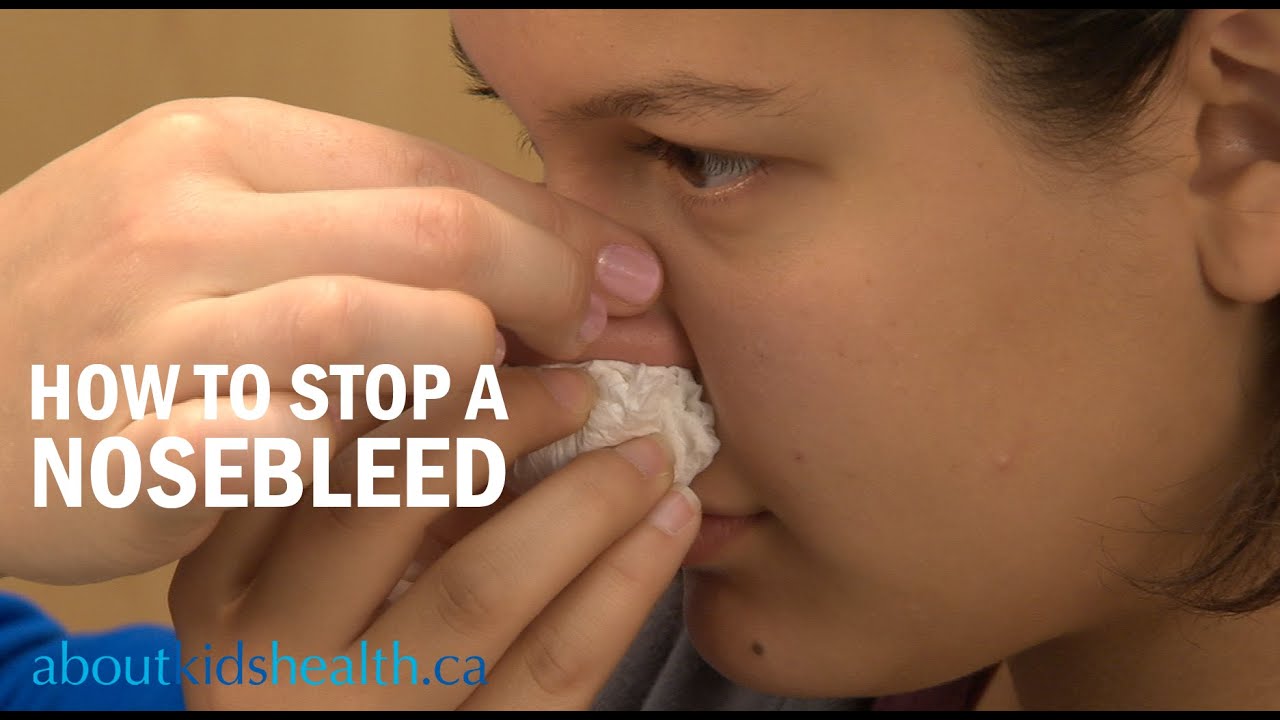 How to Stop a Nosebleed / Comment faire cesser les saignements de nez | SickKids
