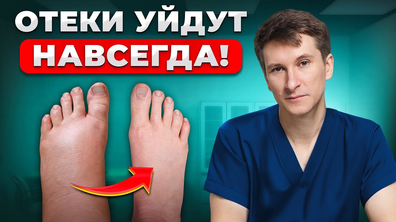 Как БЫСТРО избавиться от отеков? Настоящие причины застоя лимфы...