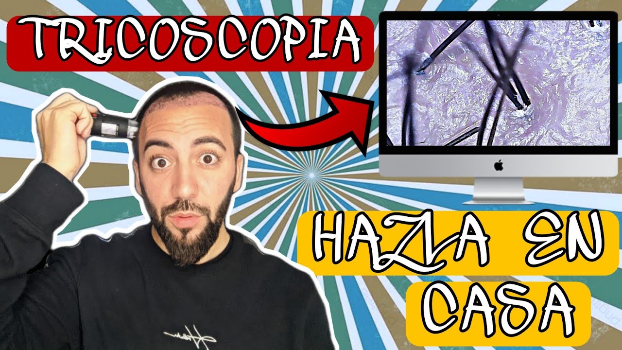 #15.- TRICOSCOPIA CAPILAR casera/Hazlo tú mismo en CASA