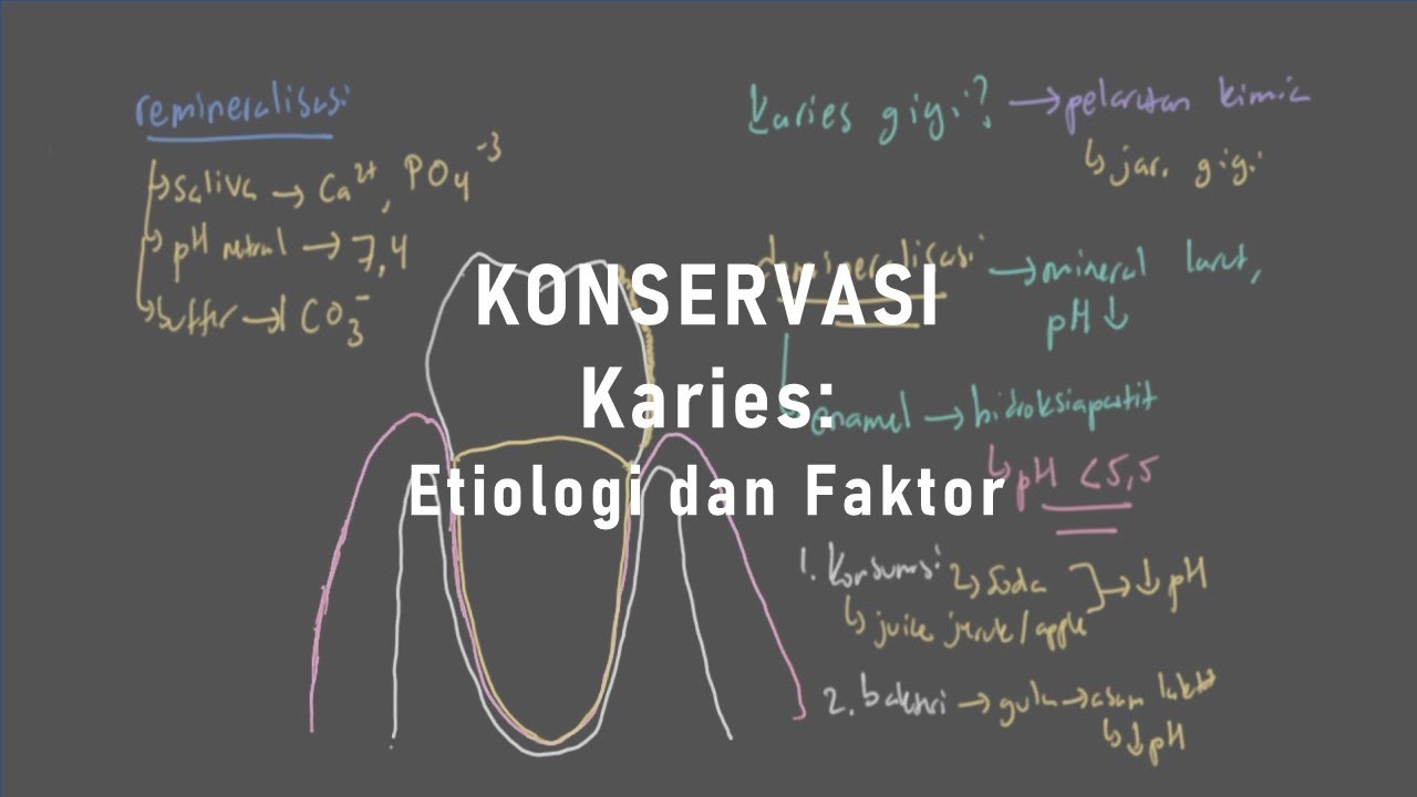 #StudySession - Konservasi | Karies: Etiologi dan Faktor