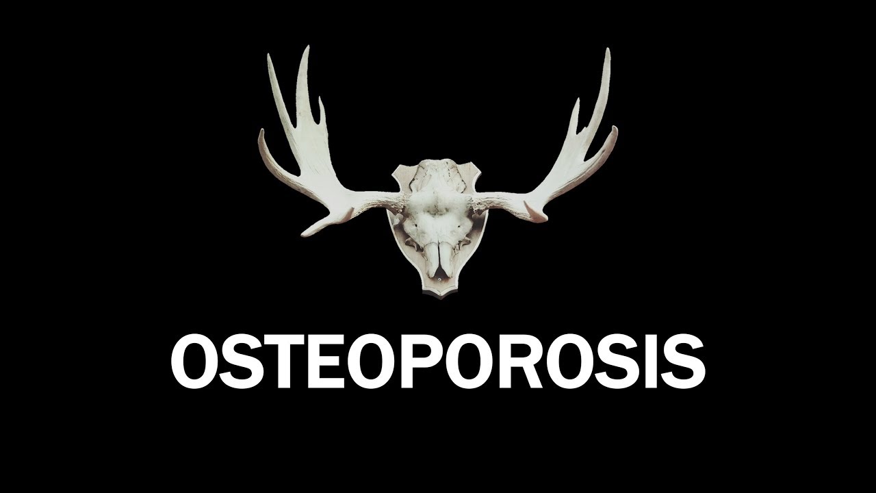 Osteoporosis: Causes and treatment