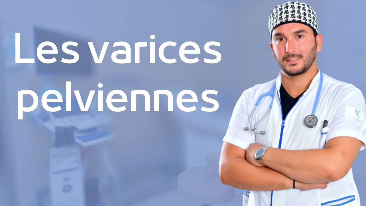 Les varices pelviennes :sympt&ocirc;mes et traitement par embolisation