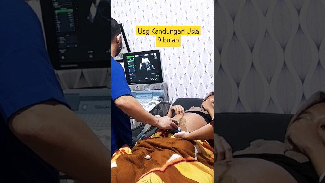 USG Kandungan Usia Kehamilan 9 Bulan