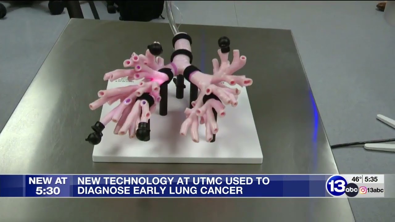 13 ABC: New Technology at UTMC Used to Diagnose Early Lung Cancer