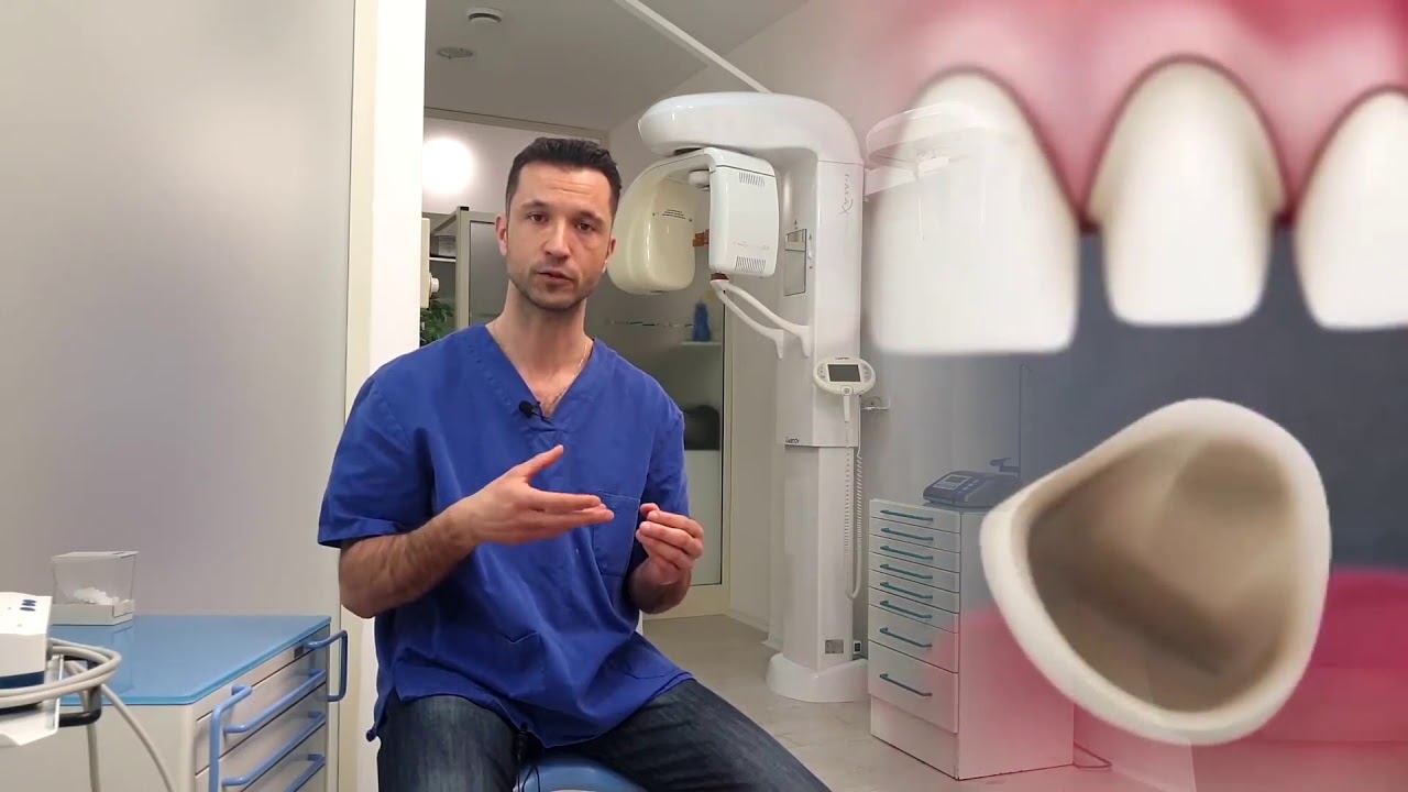 Le pillole del Dott. Simone Sasso - Un dente incapsulato va necessariamente devitalizzato?