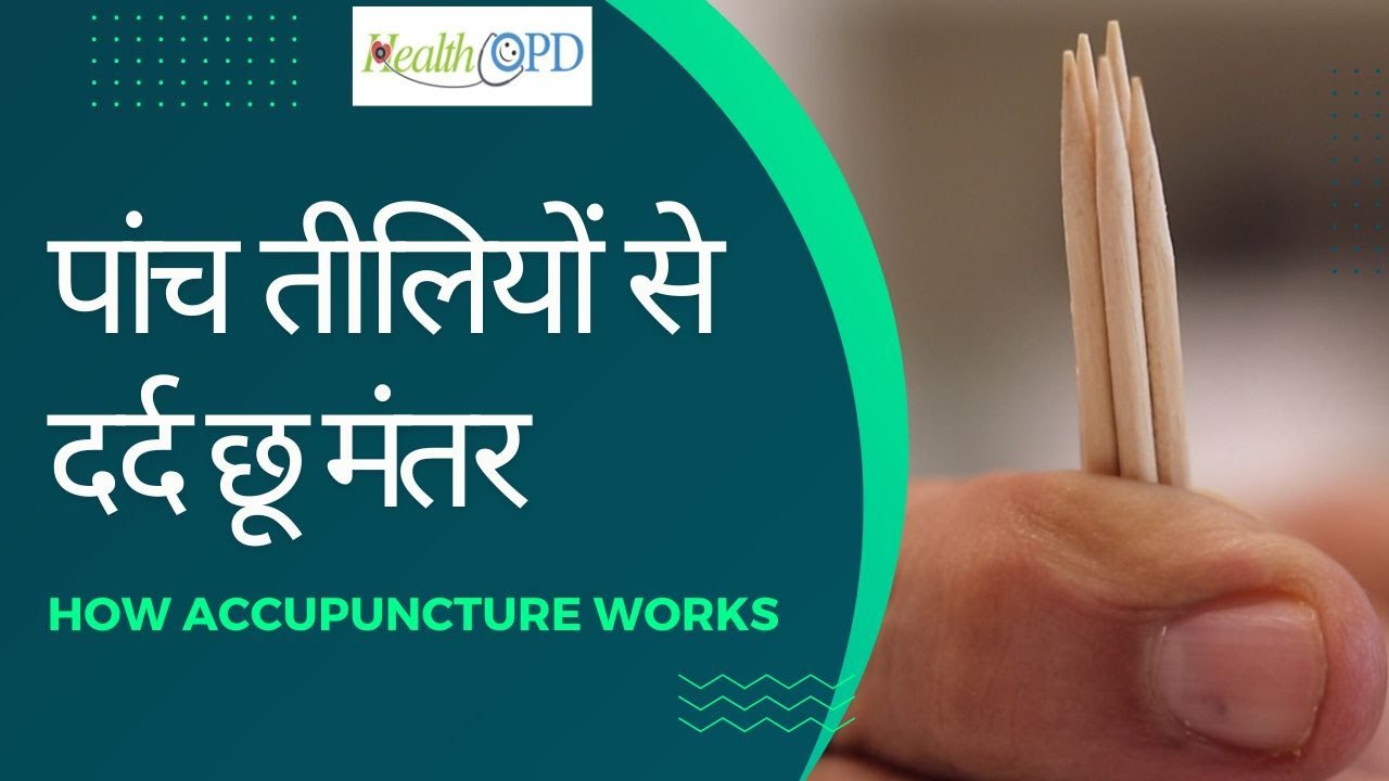 Dr. Raman Kapur - Best Acupuncture Therapy Tips in Hindi