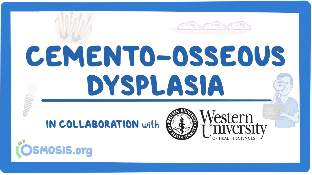 Cemento-osseous Dysplasia (in Collaboration w/ Western University)