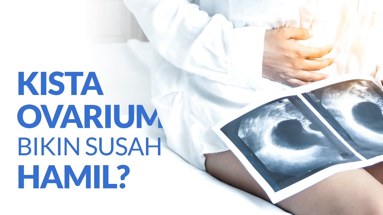 Memiliki Kista Ovarium, Apakah Masih Bisa Hamil?