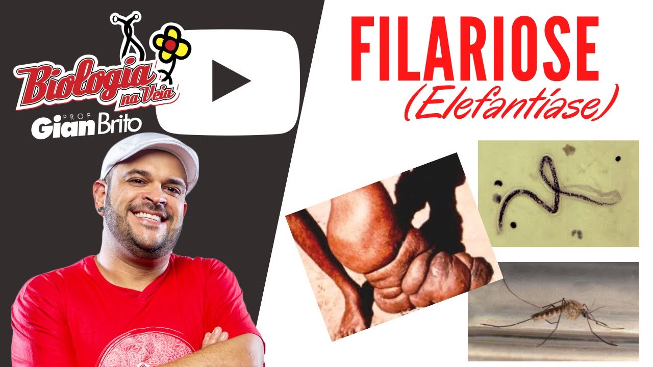 FILARIOSE