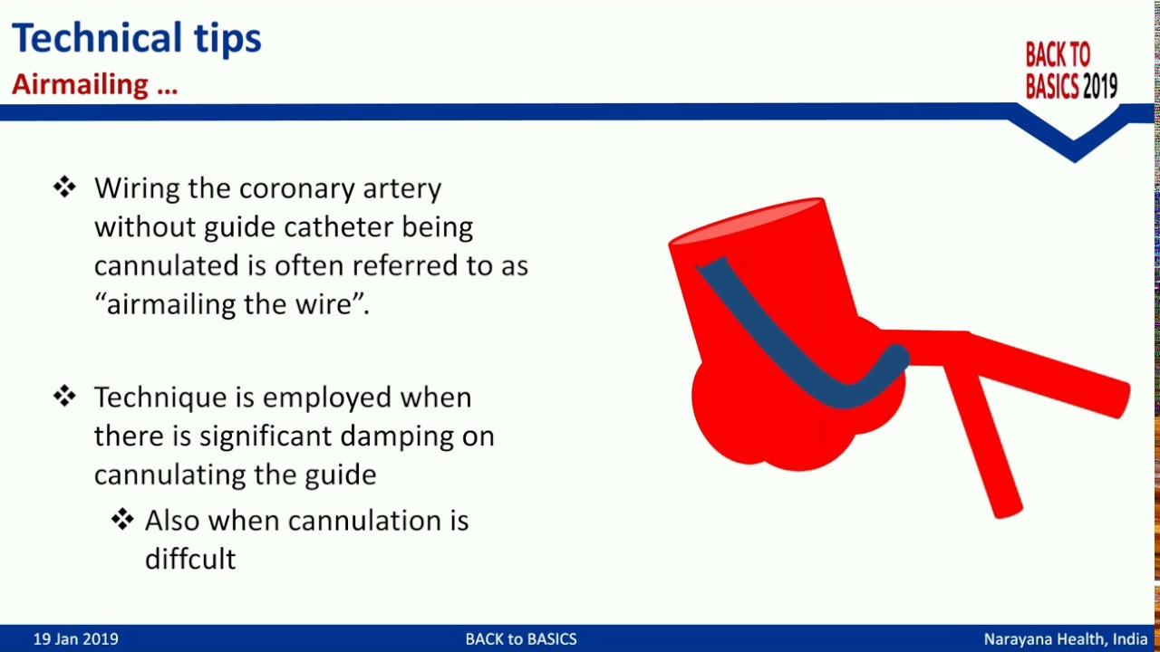 Coronary Guidewires and basic wire manipulation techniques