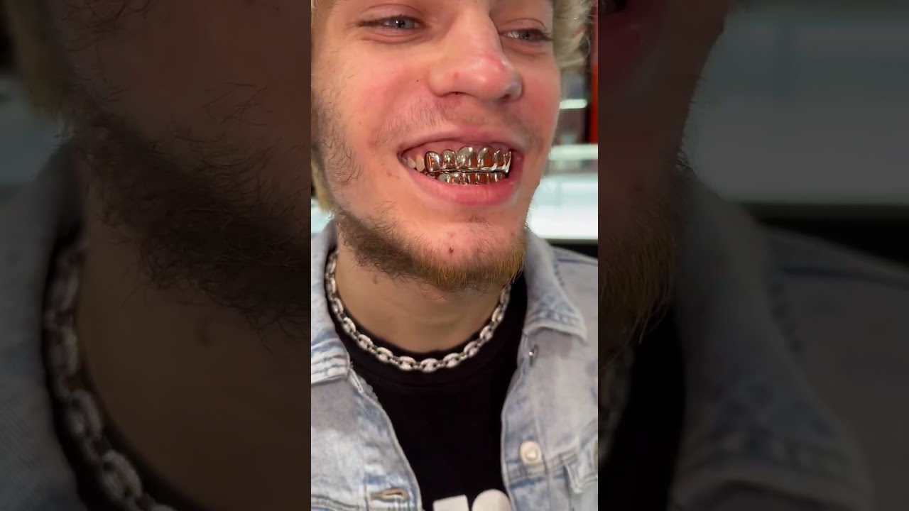 Baltimoregoldfronts.com #baltimore #goldteeth