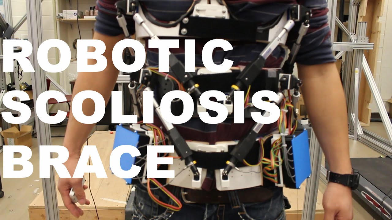 Columbia Engineers Build Robotic Scoliosis Brace