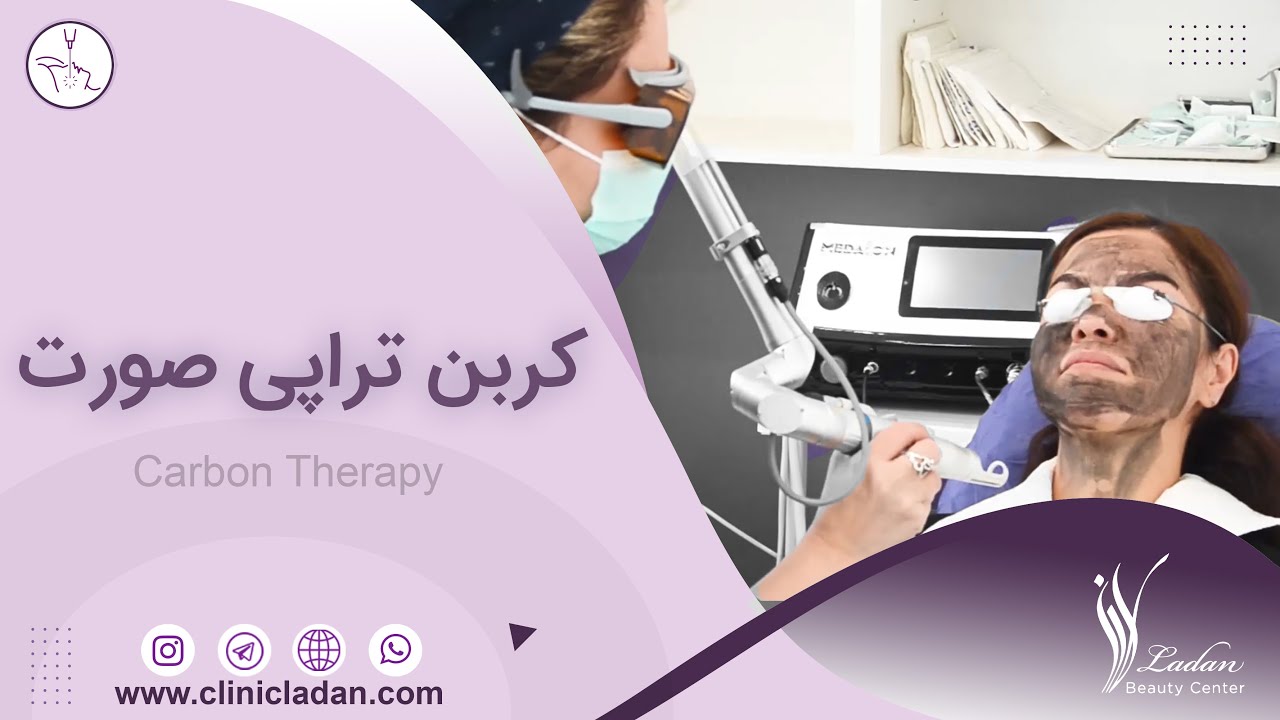 کربن تراپی صورت