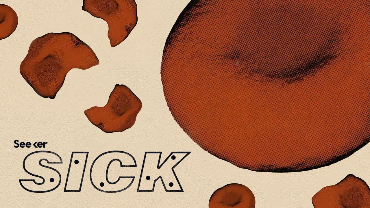 What Causes Sickle Cell...and How Are We Treating It?