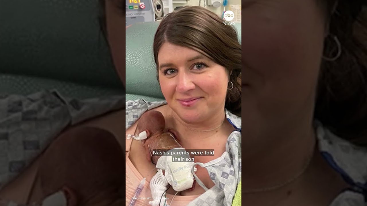 ‘World’s most premature baby’ celebrates 1st birthday