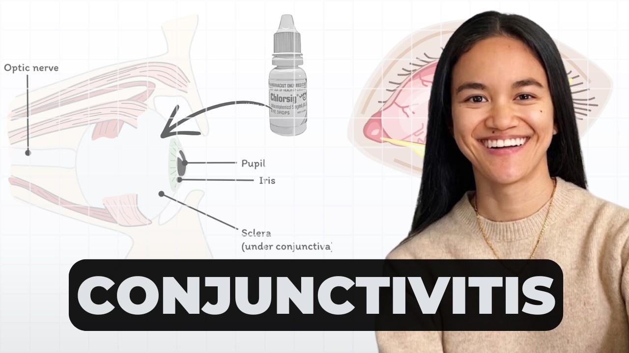 Conjunctivitis: Bacterial, Viral & Allergic - Symptoms, Diagnosis, Treatment & OSCEs