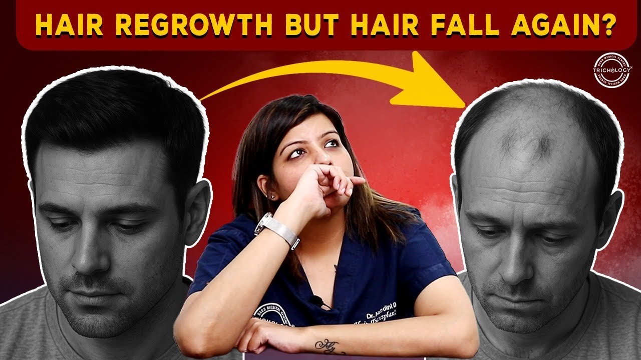 Hair Regrowth Happened… Then Hair Fall Returned? Doctor Explains the Real Reasons