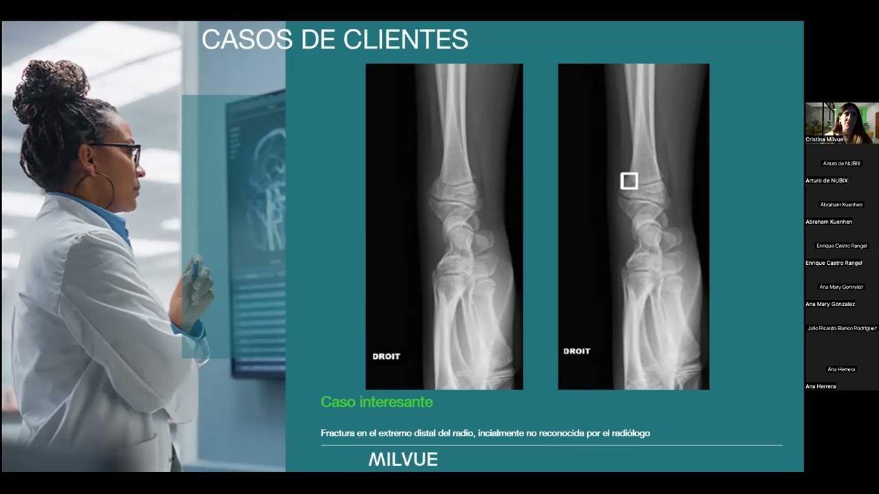 Descubre la fusión de la inteligencia artificial (IA) y radiología con Milvue y NUBIX