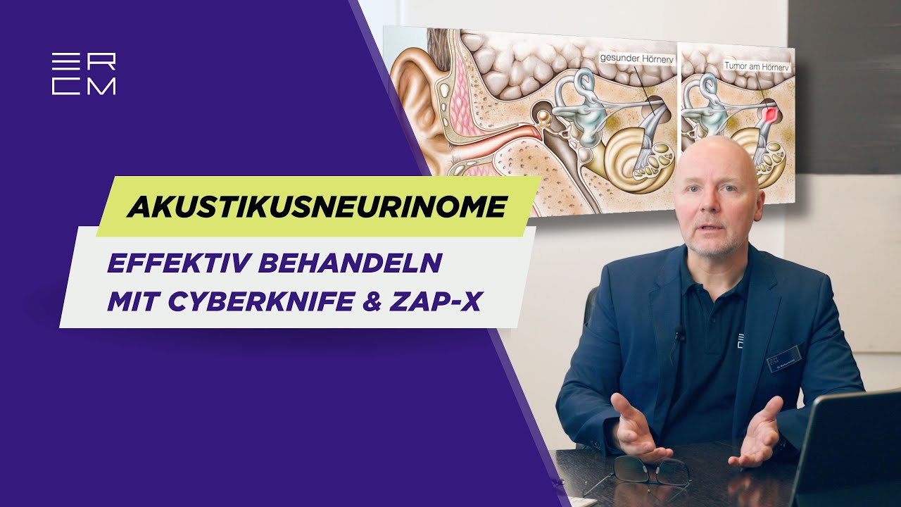 Akustikusneurinom effektiv behandeln: Radiochirurgie als Alternative zur Operation