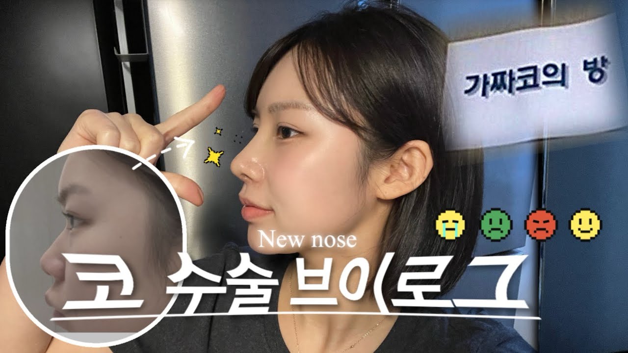 새해 기념 시New 코✨ 코수술 vlog