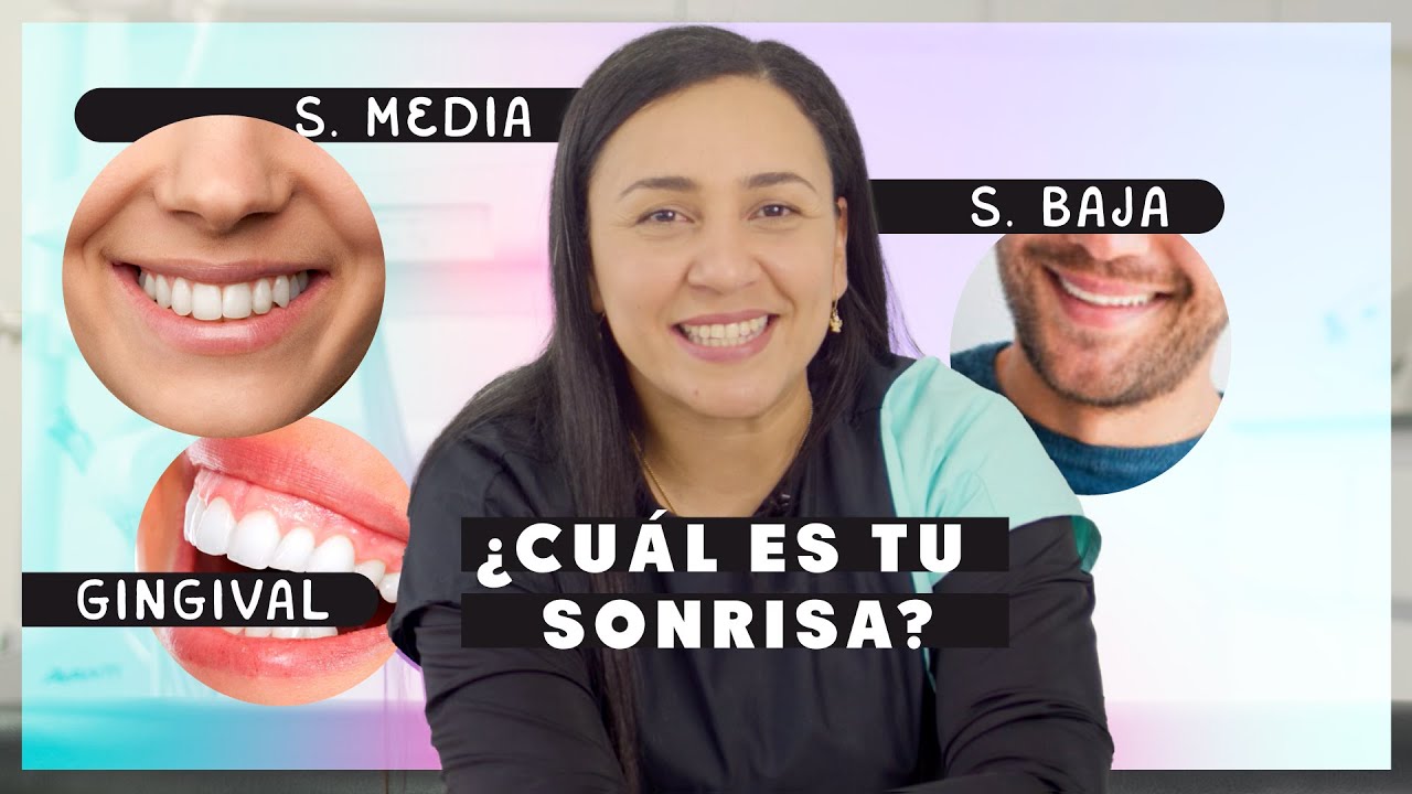 Descubre tu Sonrisa: Un Recorrido por los tipos de sonrisa. 😁