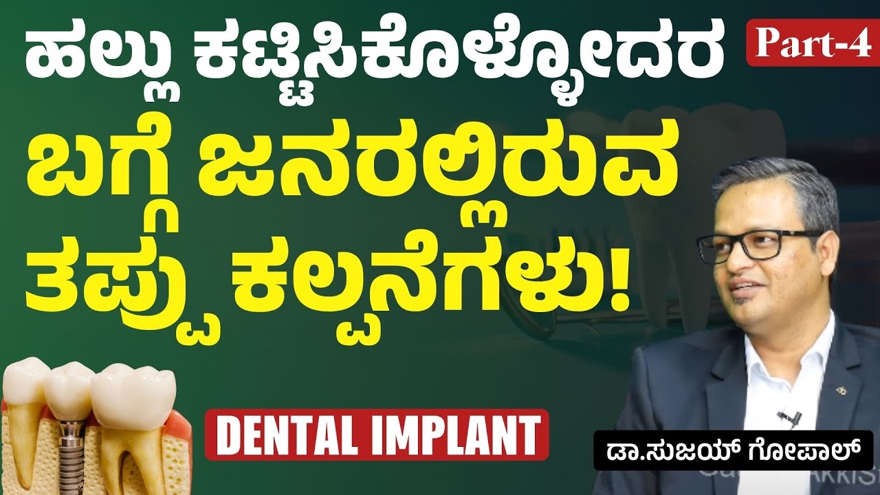 DENTAL IMPLANT ಎಷ್ಟು ಸೇಫ್..?| Myths about Dental Implant |‌ Dr Sujay Gopal| Gaurish Akki Studio
