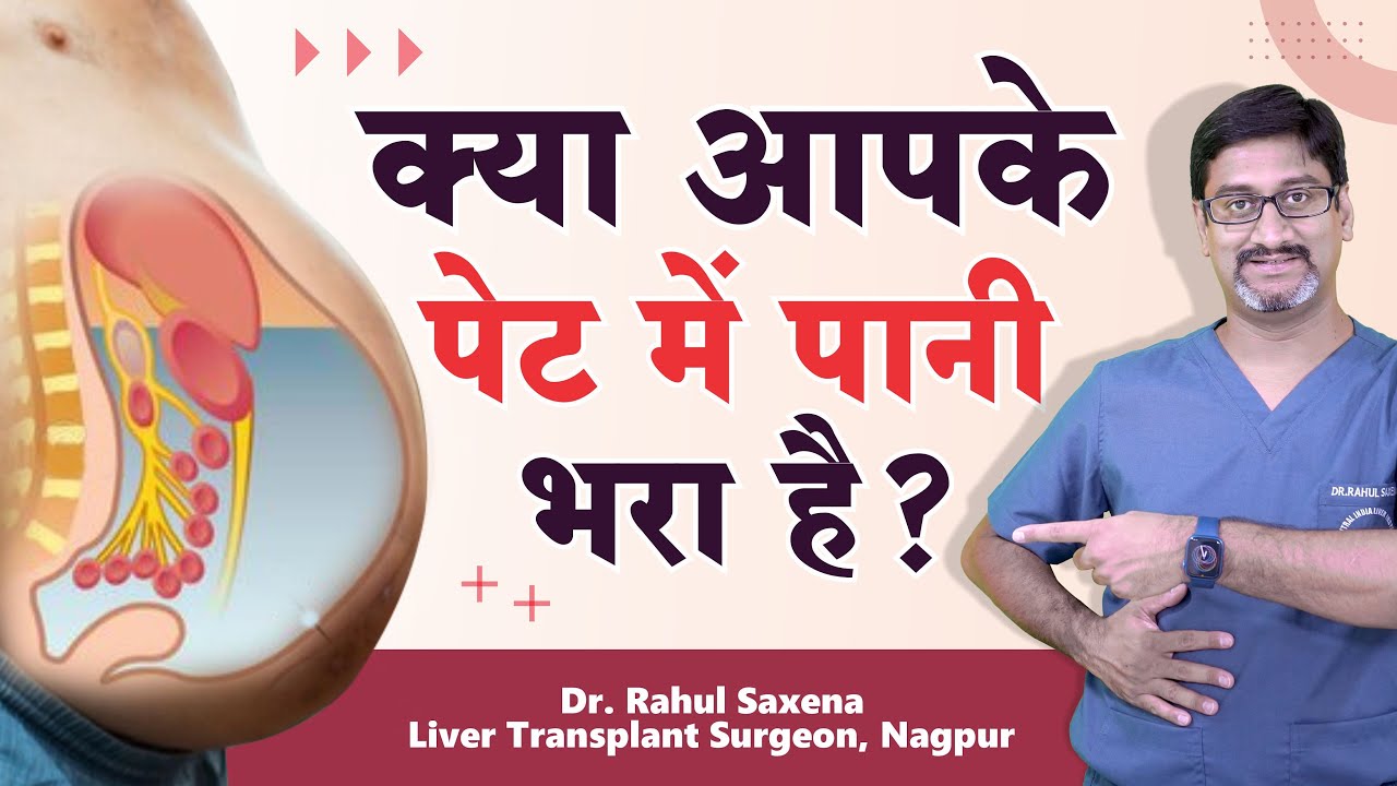 क्या आपके पेट में पानी भरा है? - Dr. Rahul Saxena