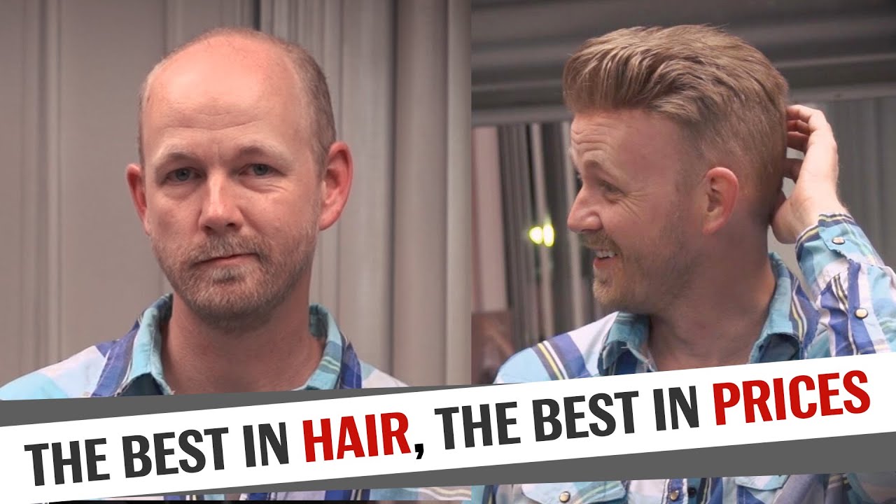 The Best in Hair, the Best in Prices | Lordhair Men's Hair Systems