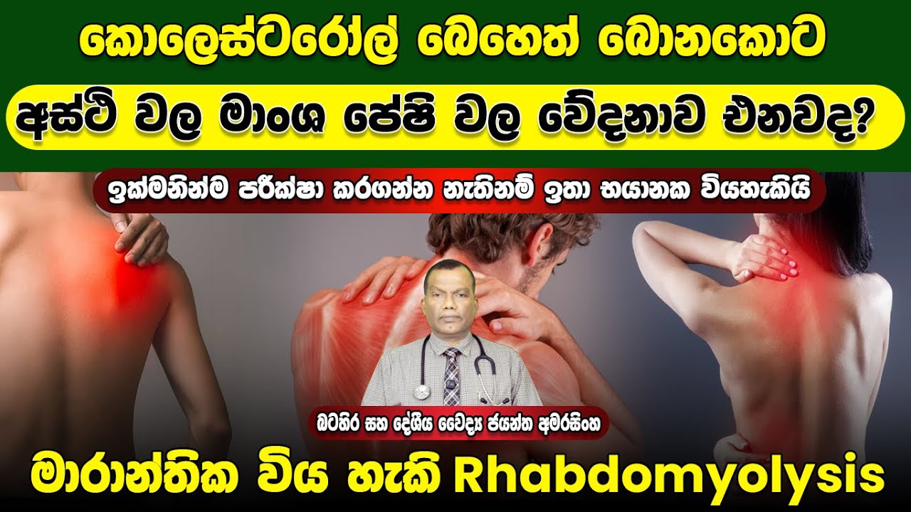කොලෙස්ටරෝල් බෙහෙත් බොනවිට මාංශ පේශි වල වේදනාව එනවනම් පරික්ෂා කරගන්න මාරාන්තික වියහැකි Rhabdomyolysis