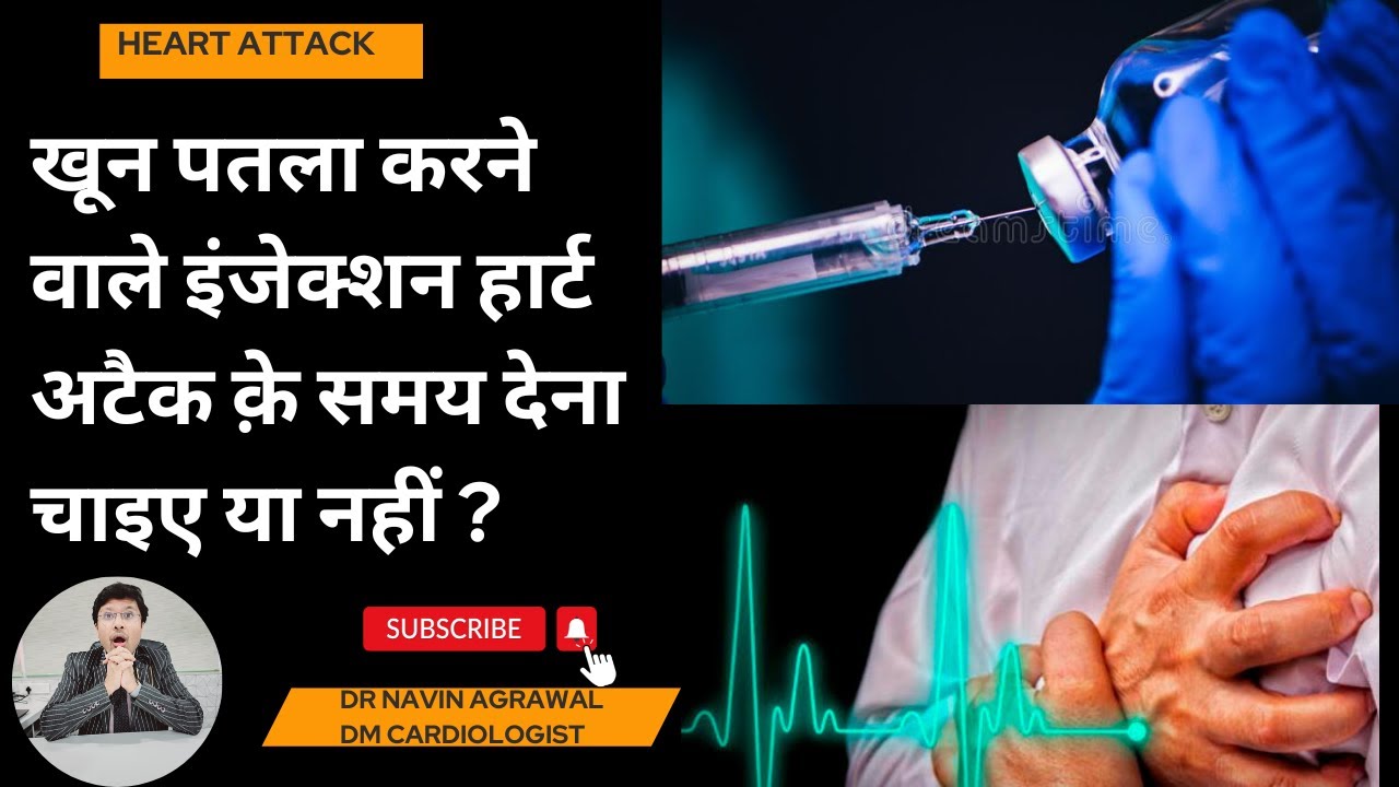 The Power of Thrombolytic Therapy in heart attacks