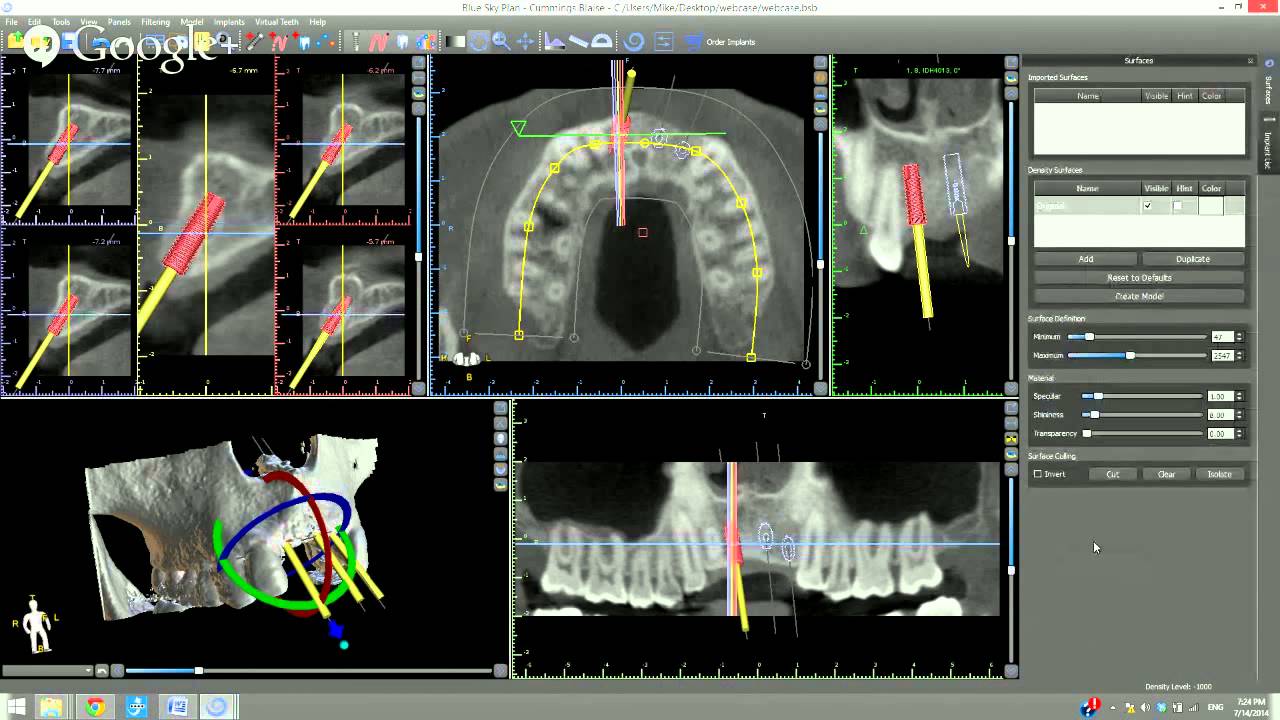 Educational Webinar: Maximizing Advanced Functionality of Blue Sky Plan
