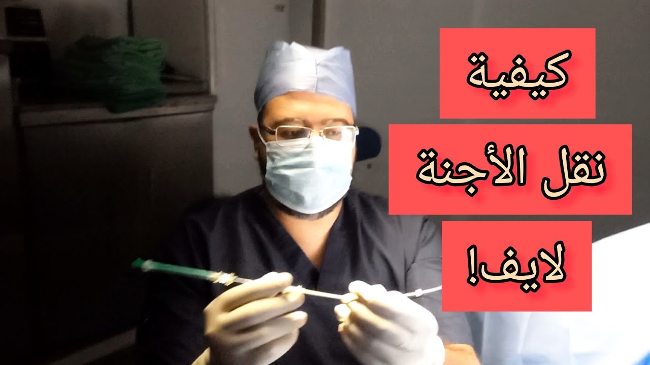 خطوات نقل الاجنة داخل الرحم اثناء الحقن المجهري لايف!| د-محمد_الشريف ❤❤