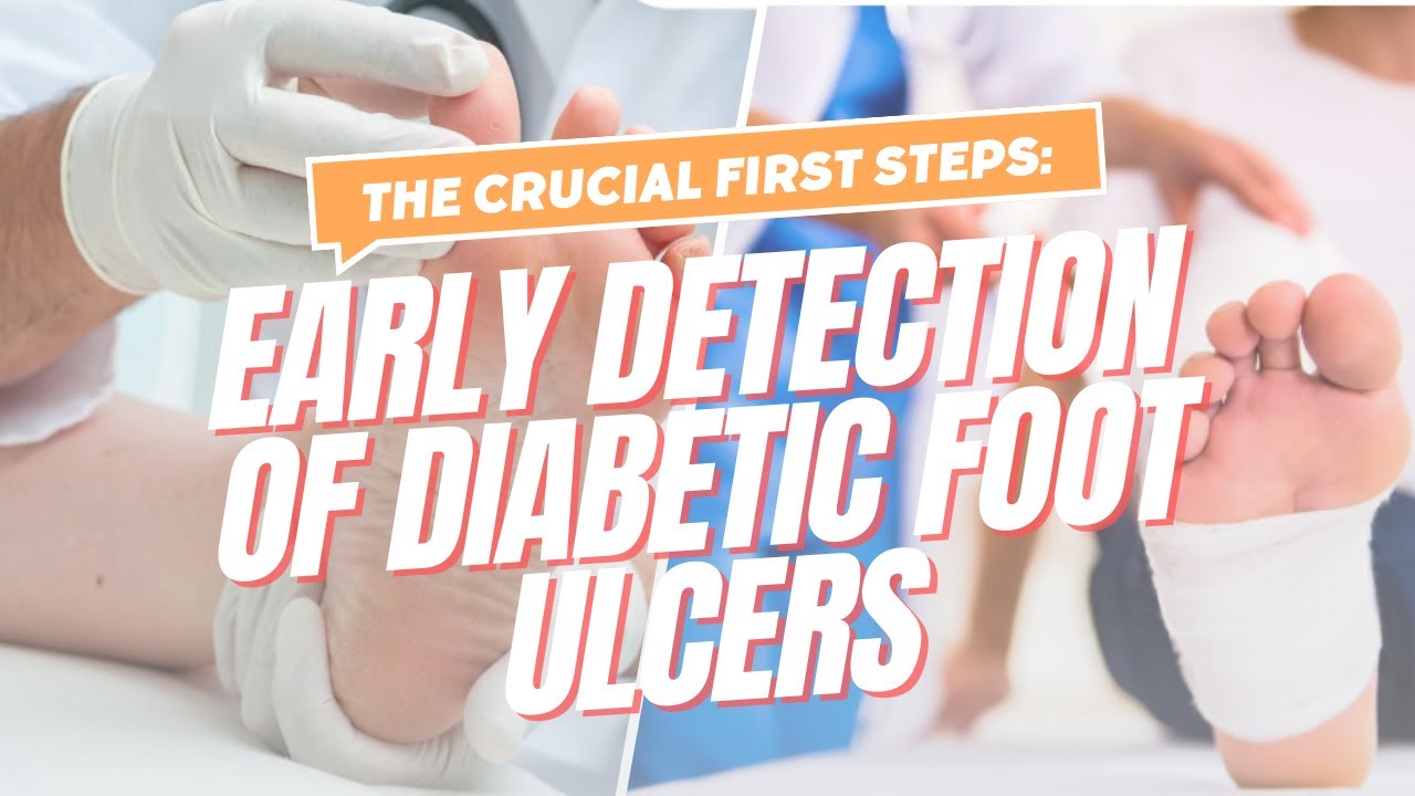 The Crucial First Steps: Early Detection of Diabetic Foot Ulcers