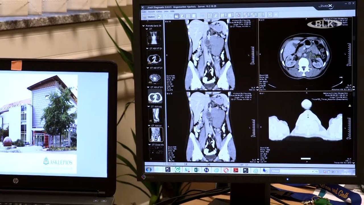Hodenkrebs Dr  Hans Jörg Scholz Chefarzt Urologie Asklepios Klinik Weißenfels