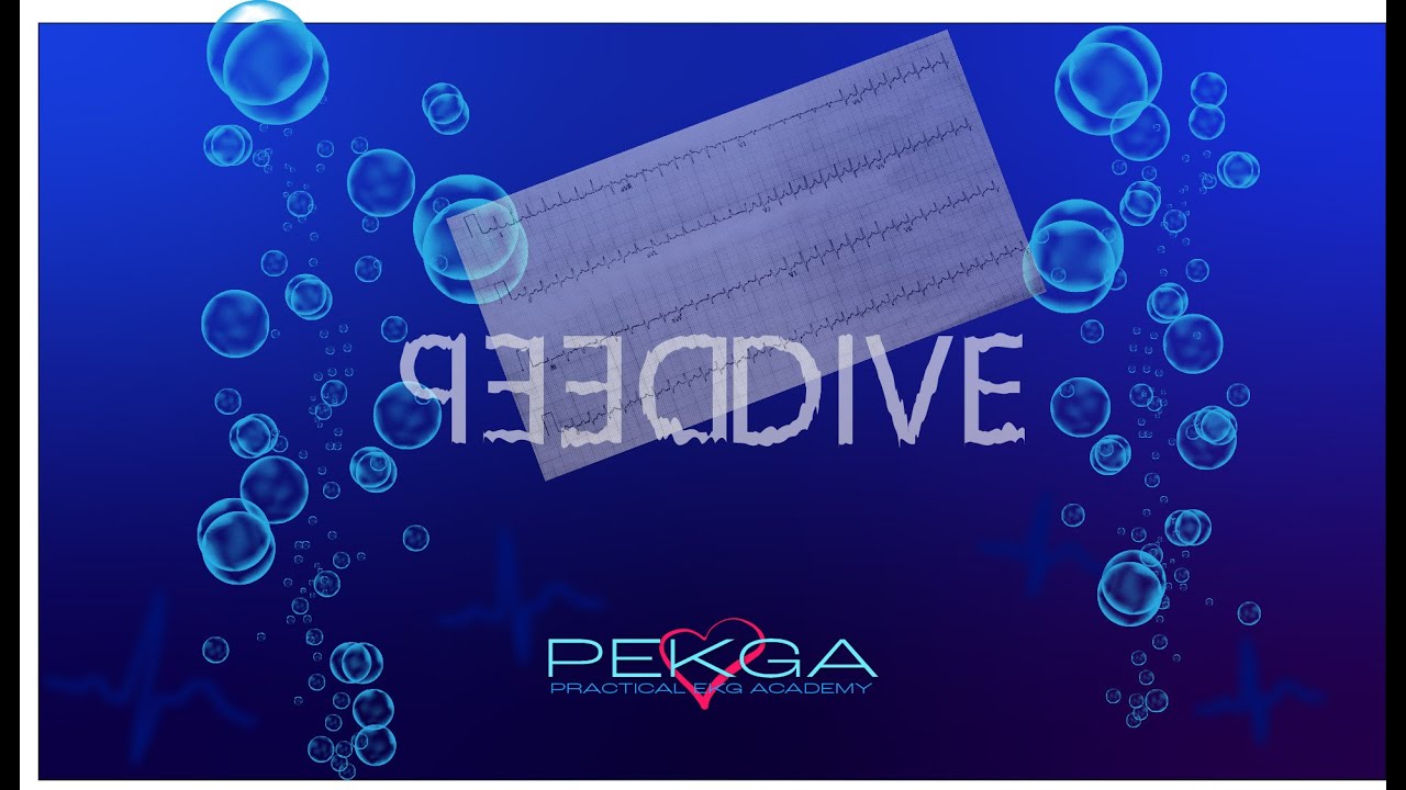 DEEP DIVE SVT PEKGA