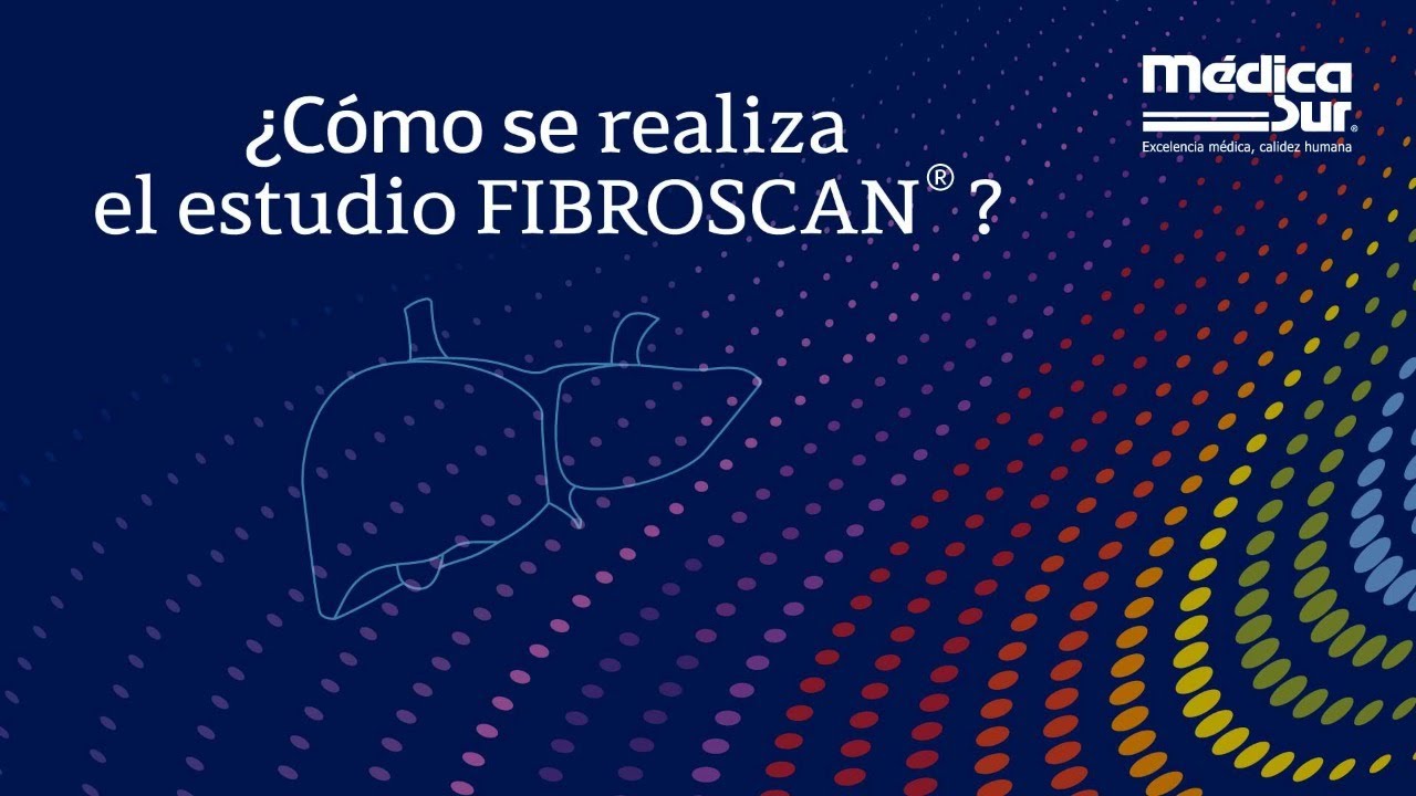 ¿Cómo se realiza el estudio de FibroScan? - Clínica de Hígado Graso de Médica Sur