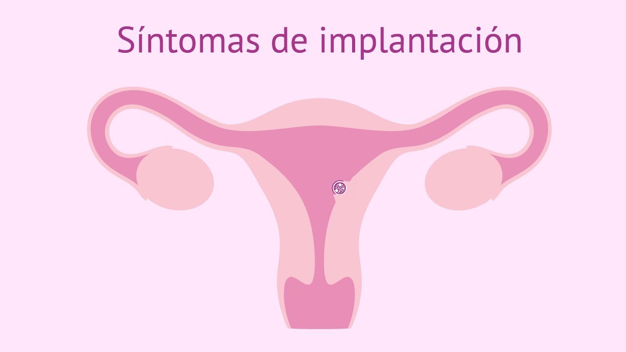 S&iacute;ntomas de implantaci&oacute;n del embri&oacute;n