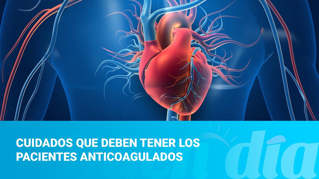 Cuidados que deben tener los pacientes anticoagulados