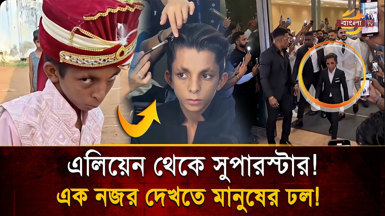 এলিয়েন' বলে ডাকত সবাই! সেই ছেলেই আজ নেটপাড়ার সুপারস্টার! | Bangla TV
