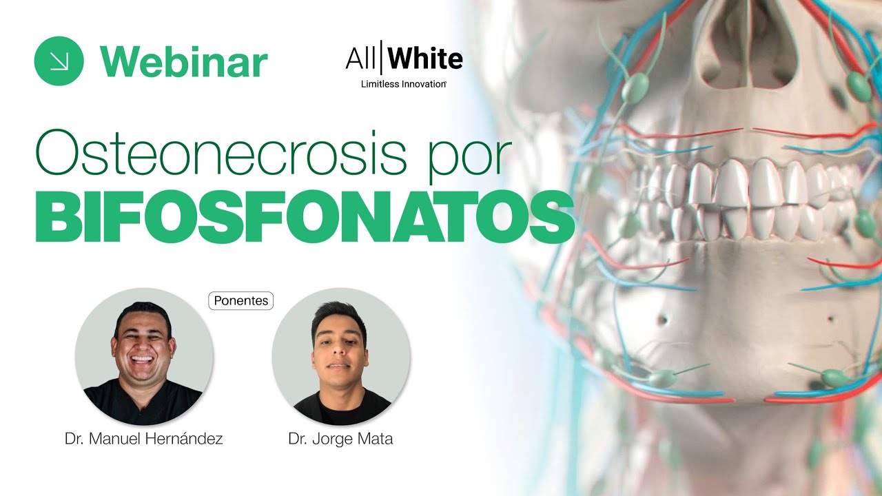 Osteonecrosis por Bifosfonatos - Dr. Manuel Hernandez & Dr. Jorge Mata