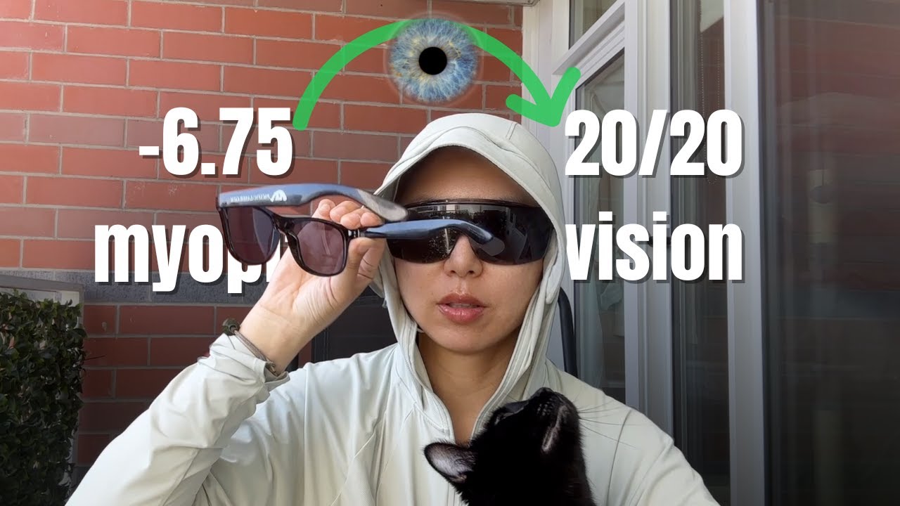 PRK Laser Eye Surgery (June 2025) | 1 week vlog (-6.75 myopia) | Kelly Kang