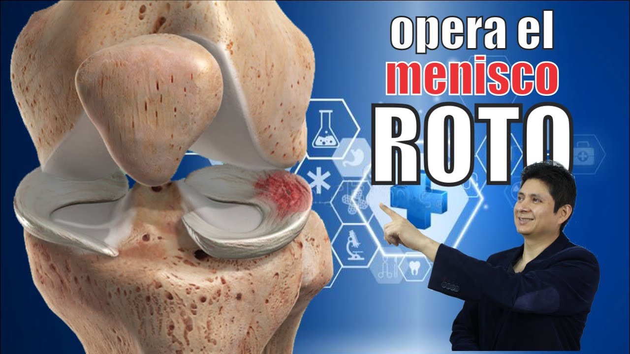 Rotura de MENISCOS 🦵🏼 Cirugía ARTROSCÓPICA de RODILLA ⭐ Dr WALTER ALVARADO Traumatología 24 hrs