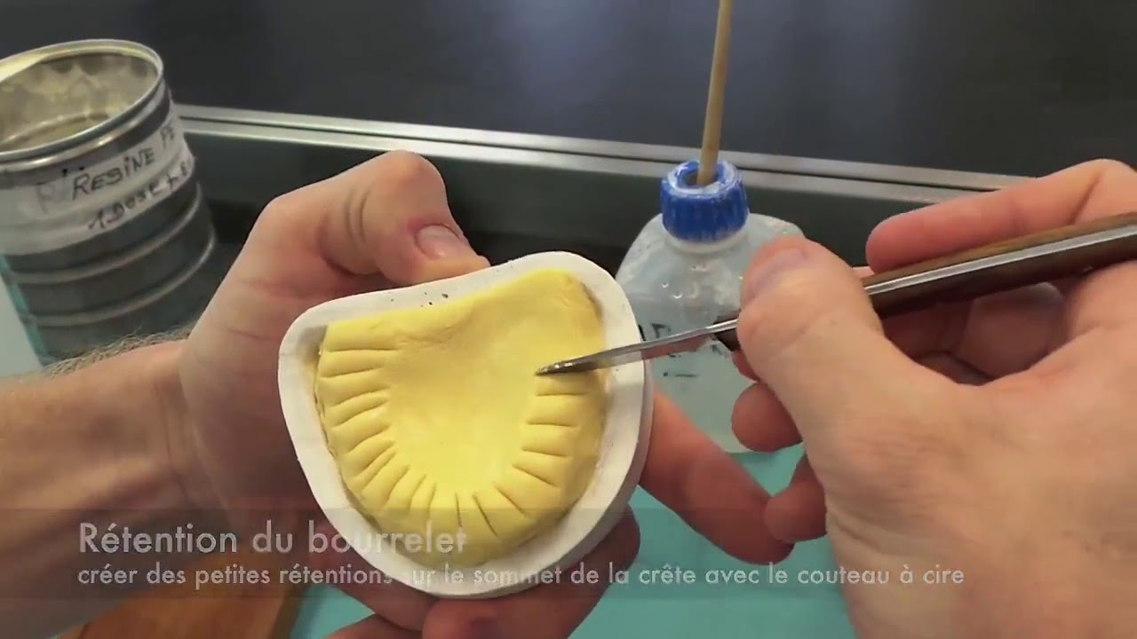 7-réalisation du PEI, plaque base - prothèse complète adjointe