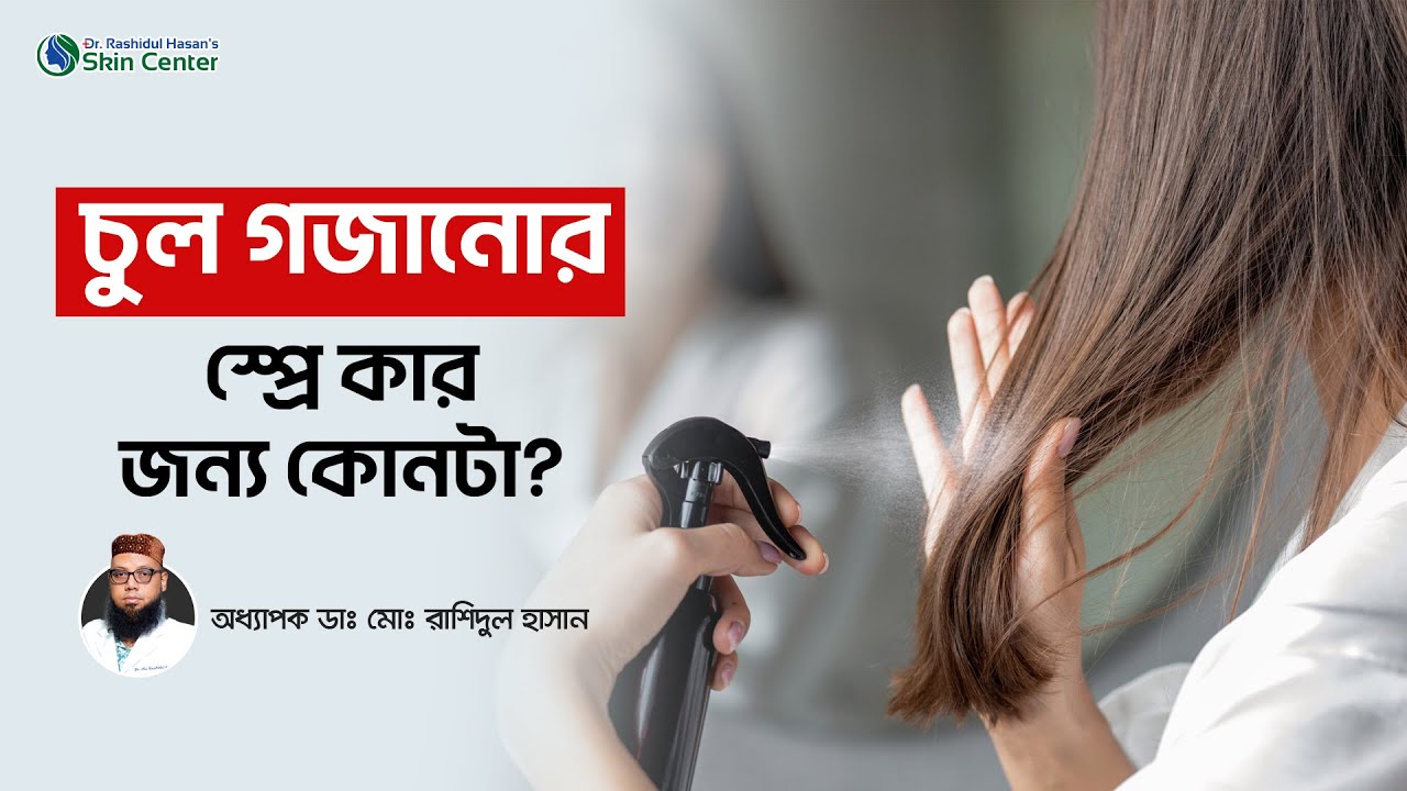 চুল গজানোর স্প্রে কার জন্য কোনটা | Minoxidil Hair Spray Regrowth Results | Hair Regrowth Spray